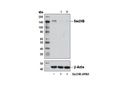 Sec24B (D7D6S) Rabbit mAb
