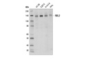 RBL2 (D9T7M) Rabbit mAb