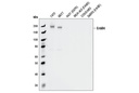 HER4/ErbB4 (111B2) Rabbit mAb