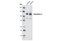 Neuropilin-2 (D39A5) XP Rabbit mAb