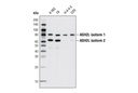 ASH2L (D93F6) XP Rabbit mAb