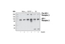 IGF-I Receptor β (111A9) Rabbit mAb