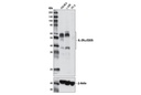IL-2Rα/CD25 (D6K5F) Rabbit mAb
