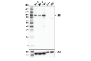SLFN11 (D8W1B) Rabbit mAb