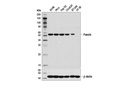 Fascin (55k-2) Mouse mAb