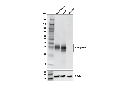 Granzyme H (E4T2E) Rabbit mAb