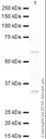 Anti-Aromatase antibody