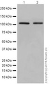 Anti-CHD1L抗体[EPR14515(2)]