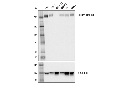 PBRM1/BAF180 (E9X2Z) Rabbit mAb