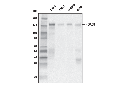 HDAC5 (E6G3N) Mouse mAb